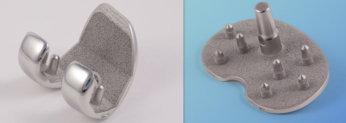 Example photos of cementless knee implant coatings